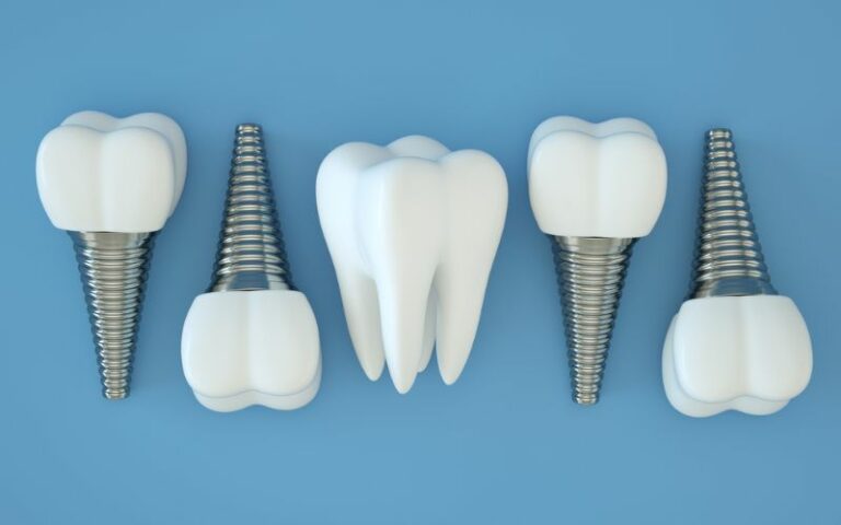 multiple dental implants on blue background